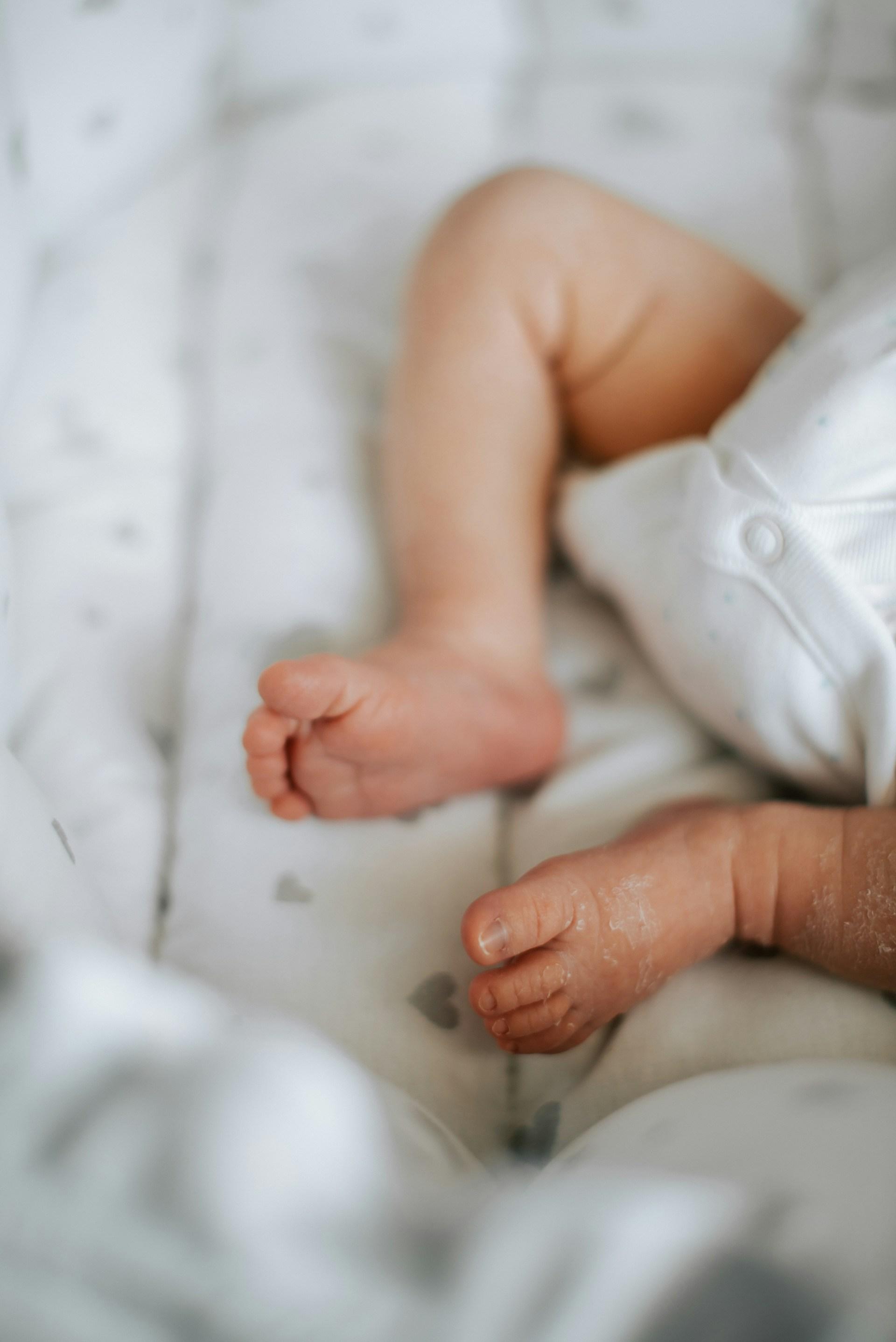 Newborn nappy showing mustard yellow stool and meconium