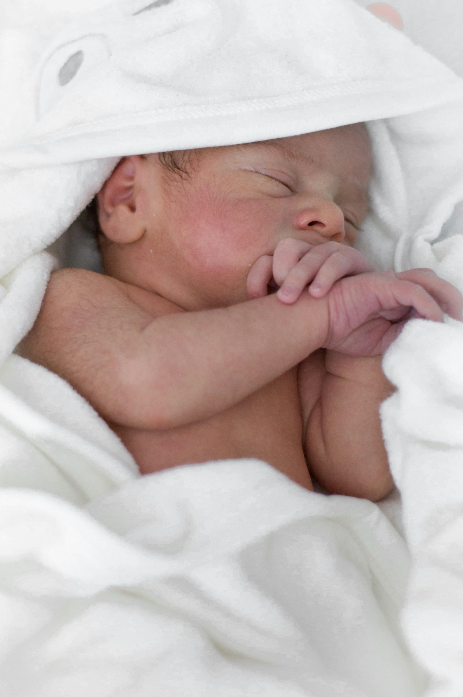 Newborn with soft skin showing mild rash and peeling
